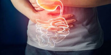 4 Tips Menjalani Puasa bagi Pengidap Mag ala Dokter RSA UGM