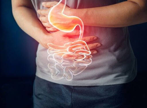 4 Tips Menjalani Puasa bagi Pengidap Mag ala Dokter RSA UGM